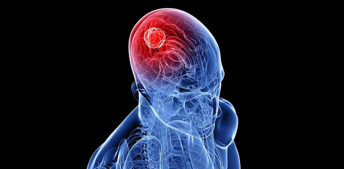 Beyin tümörüne karşı devrim yaratan yöntemler…